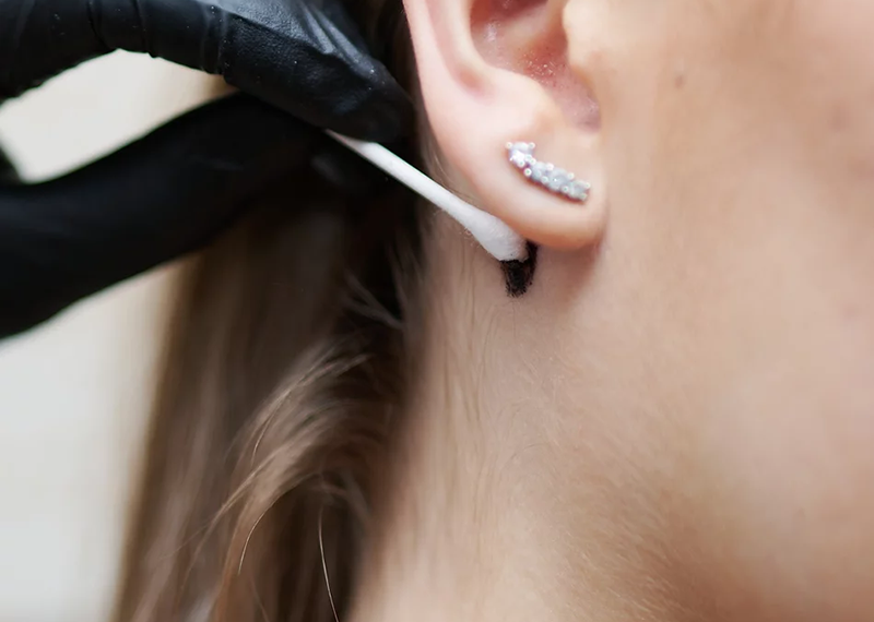 Patch test